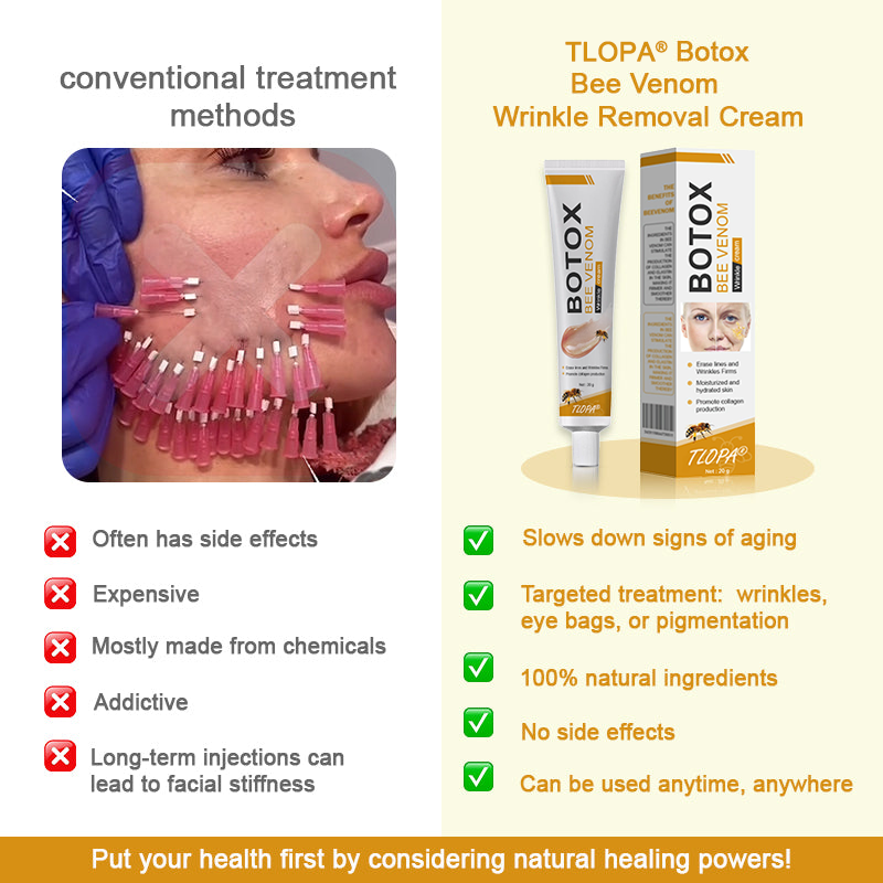 (Made and Shipped from USA✅) TLOPA®Botox Bee Venom Wrinkle Removal Cream- LAST DAY 80% OFF