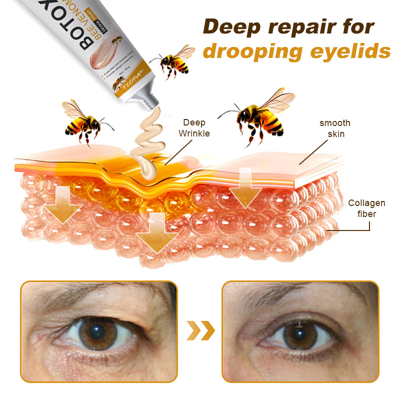(Made and Shipped from USA✅) TLOPA®Botox Bee Venom Wrinkle Removal Cream- LAST DAY 80% OFF