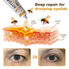 (Made and Shipped from USA✅) TLOPA®Botox Bee Venom Wrinkle Removal Cream- LAST DAY 80% OFF