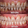 Ourlyard™ Tooth Powder
