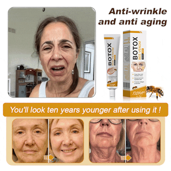 (Made and Shipped from USA✅) TLOPA®Botox Bee Venom Wrinkle Removal Cream- LAST DAY 80% OFF
