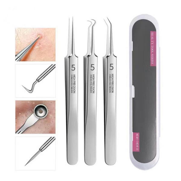 Professional Facial Blackhead Remover Tweezers (3Pcs+Box) – Biradu