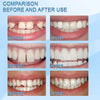 Zulinu™ Tooth Repair Granules