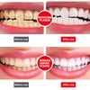 All Smiles -Brightening & Stain Removing Probiotic Toothpaste